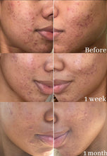 Load image into Gallery viewer, Osun Oil®